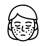 LÚPUS - DR VICTOR